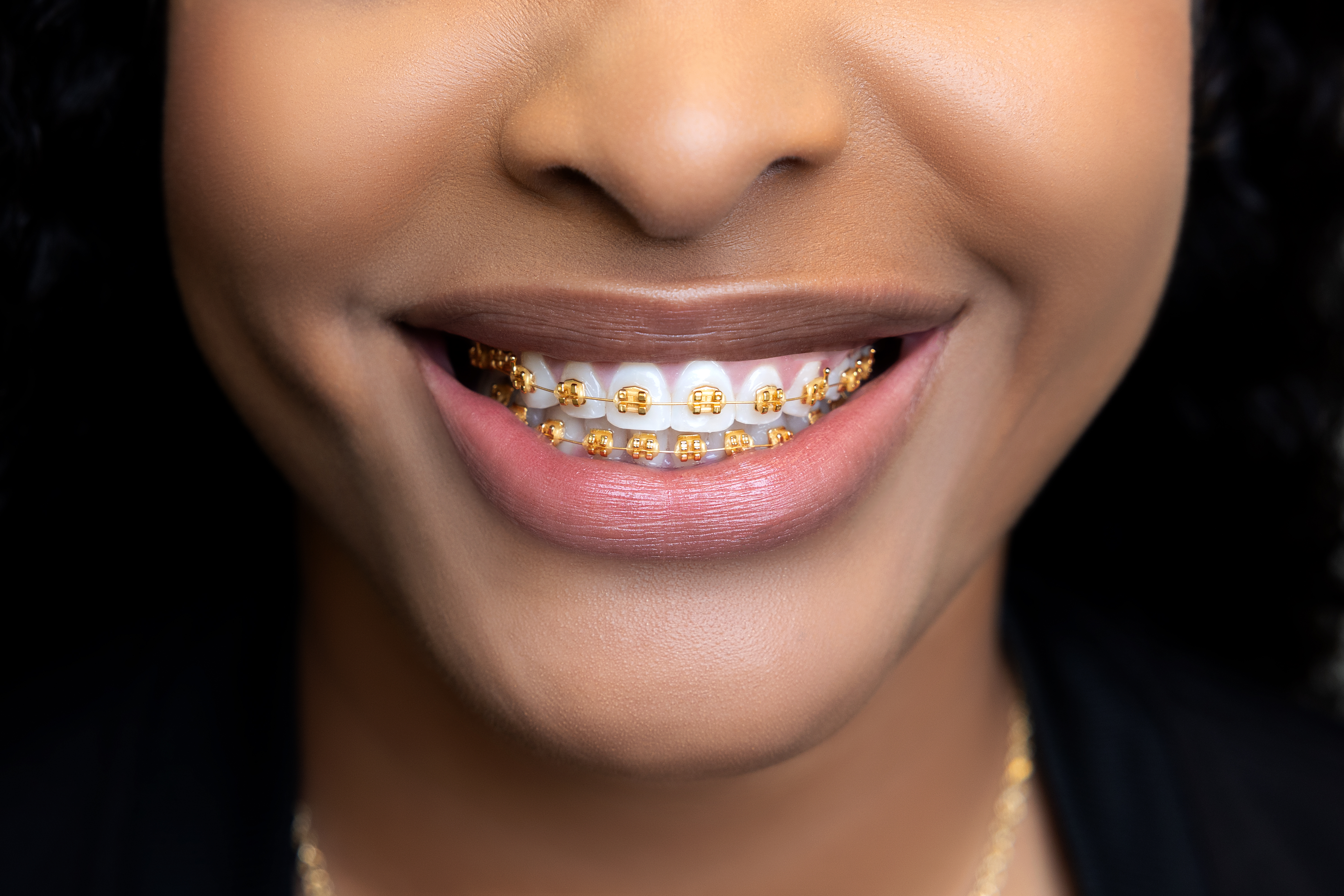 Happy Patient with Braces